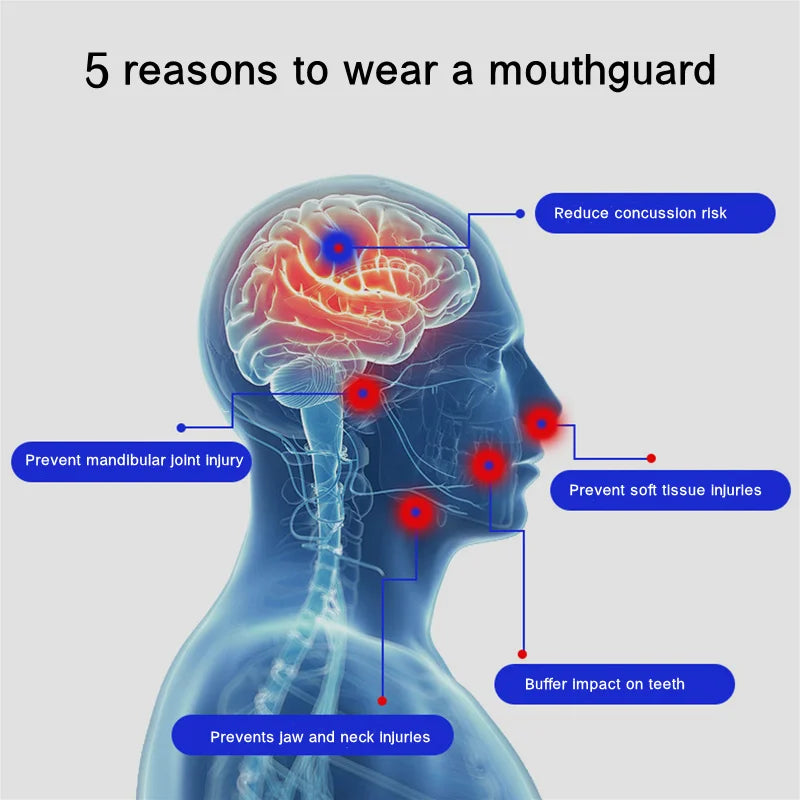FlexGuard Combat Mouthguard
